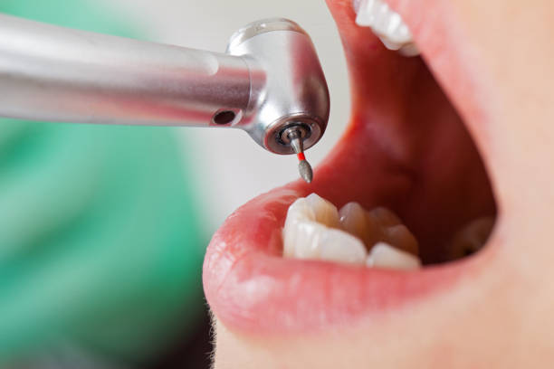 Best Emergency Dental Extractions in Hokes Bluff, AL